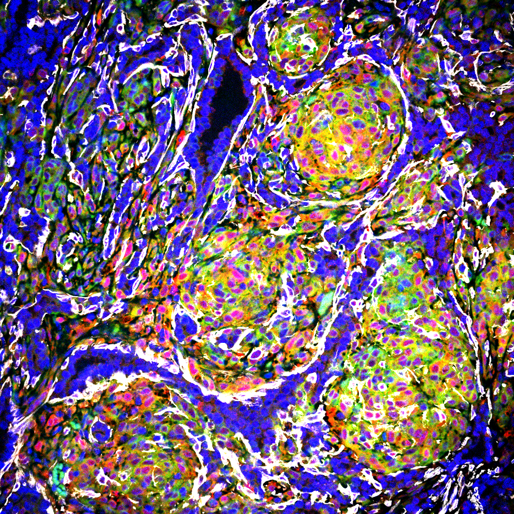 Mouse mammary tumour