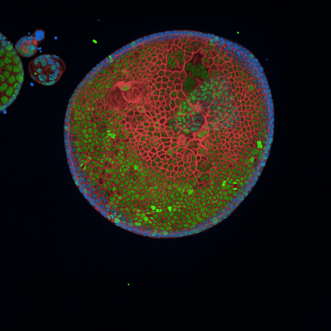 Pancreatic-organoids-3D