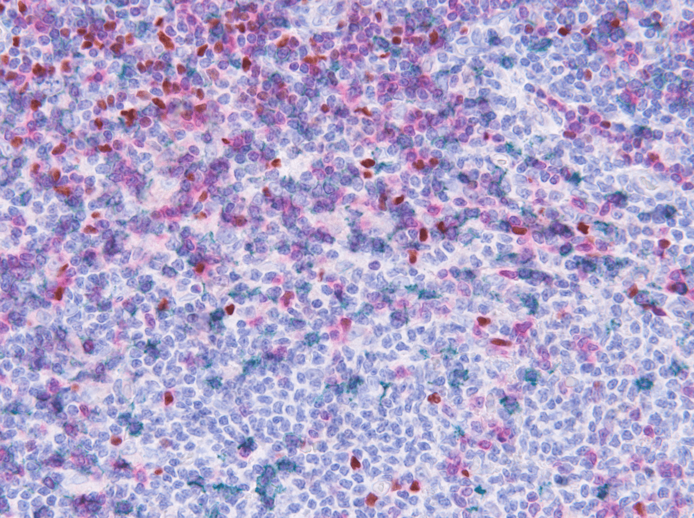 Lung cancer research graphical representation