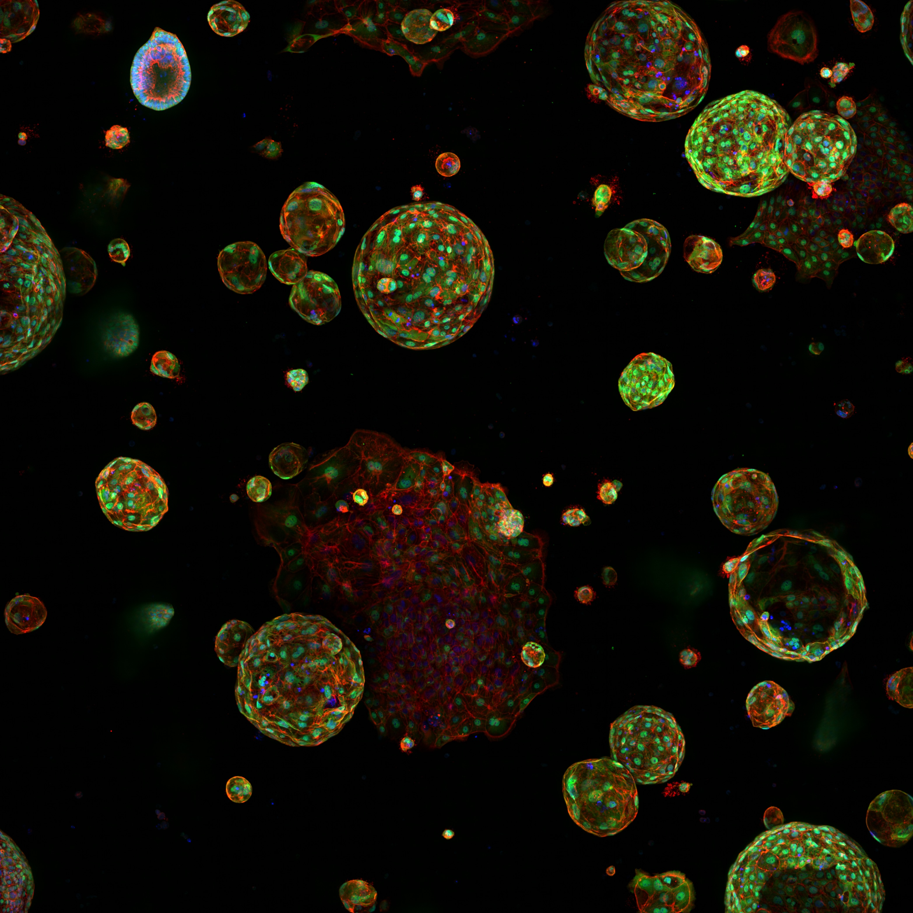 Pancreatic cancer organoids graphic
