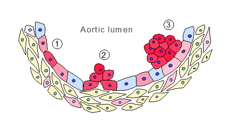Georges aortic luman image