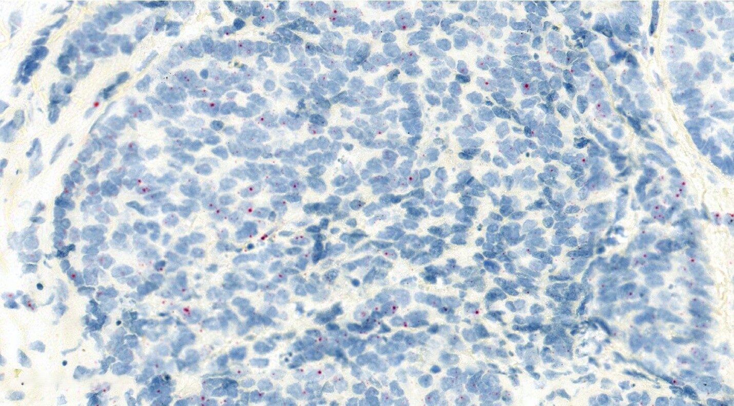 Prostate tissue-1-Runx