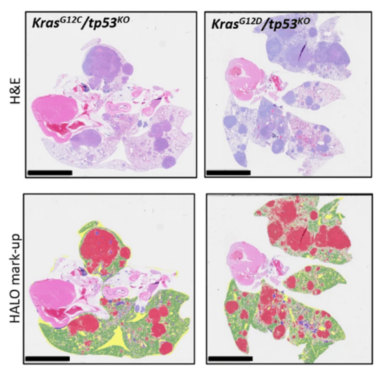 A publication graphic relating to non-small cell lung cancer