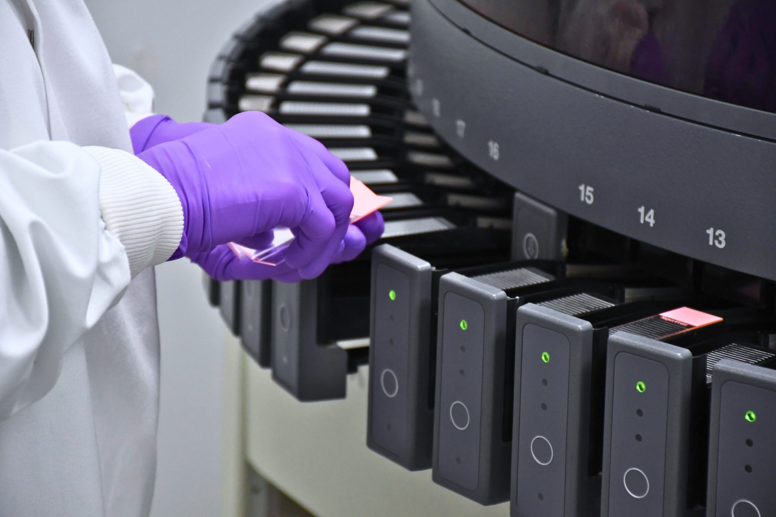 Researcher using equipment for bond slide loading in a laboratory focused on cancer studies