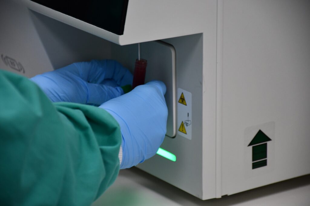 Gloved hands loading blood sample