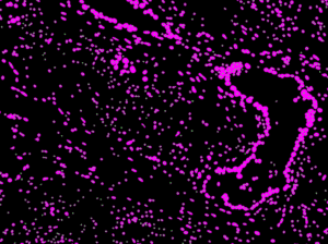 Image processing and segmentation image
