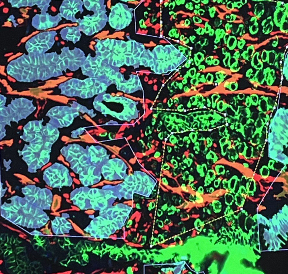 Scientific image labelled 'Spatial-2,' depicting data related to spatial analysis in research
