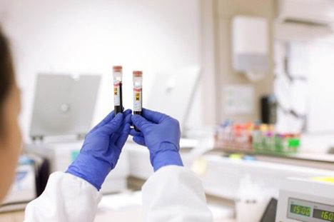 Scientist holding tubes with blood sample