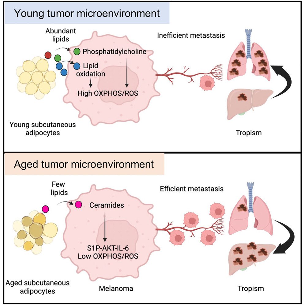 Graphical abstract for Stromal lipid species dictate melanoma metastasis and tropism publication